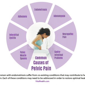 causes-of-pelvic-pain - Vital Health Endometriosis Center